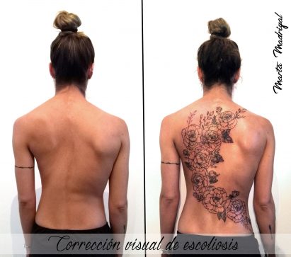 corrección visual escoliosis tattoo palencia